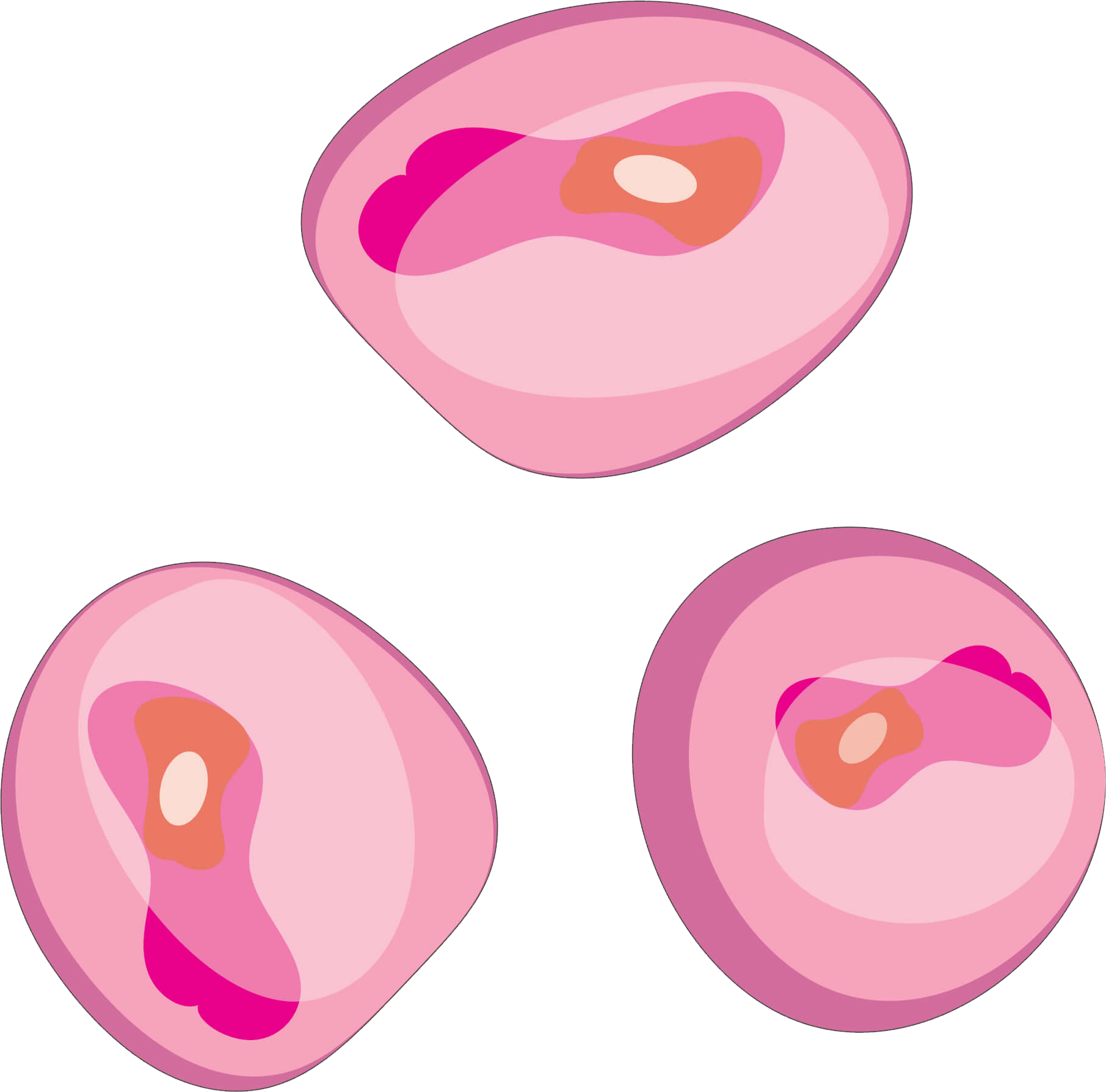 Cancerous cells varying in size and shapes