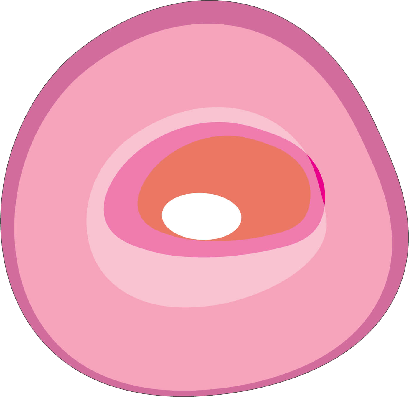 Cancerous cell with a larger and darker nucleus